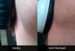 v2_ohrumschliessend.jpg